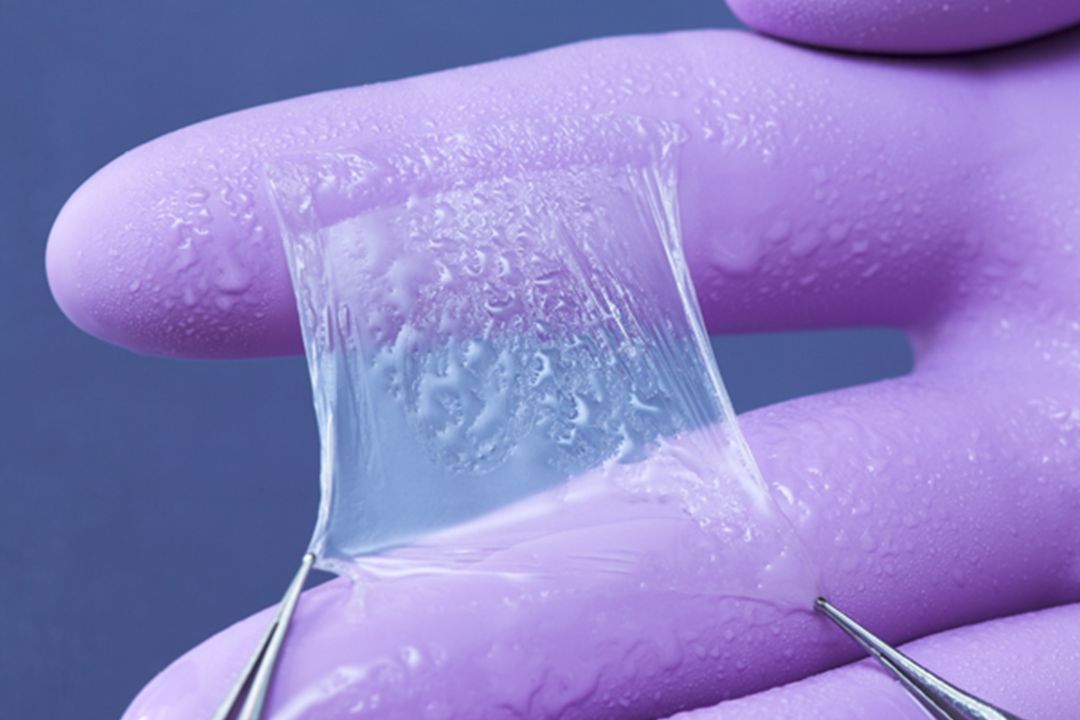 Amniotic Membrane Market: Growth Driven by Regenerative Medicine Advancements